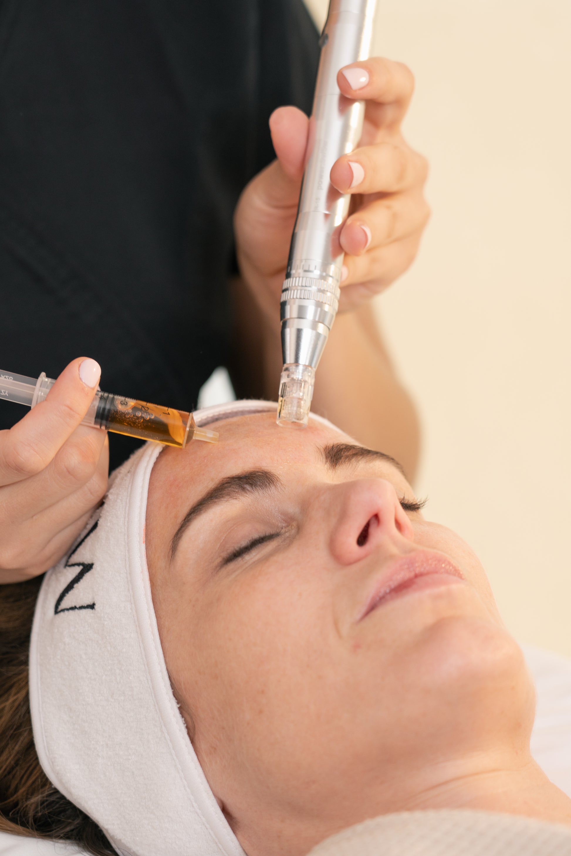 Microneedling by Mesoestetic